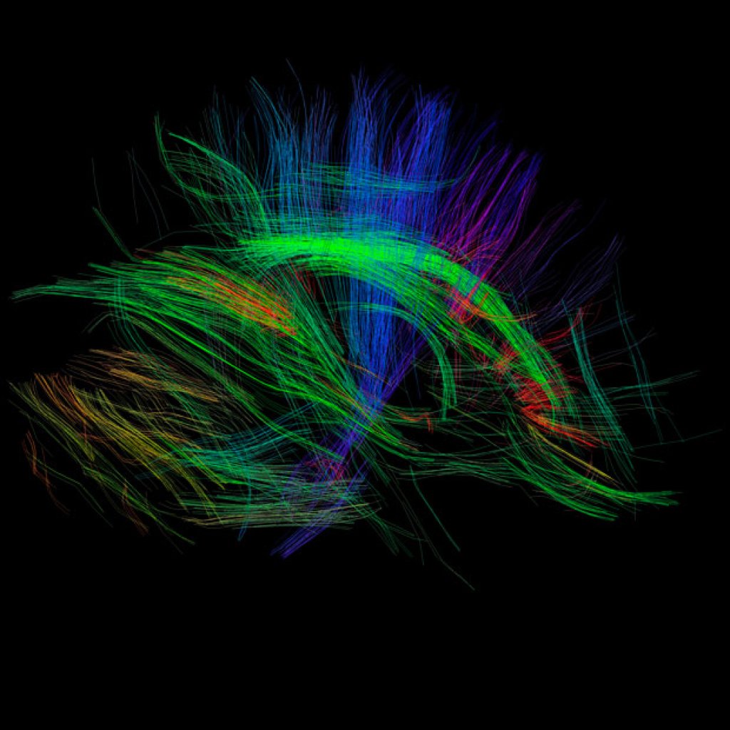 Diffusion magnetic resonance imaging of a human brain showing some of the most important nerve fiber bundles