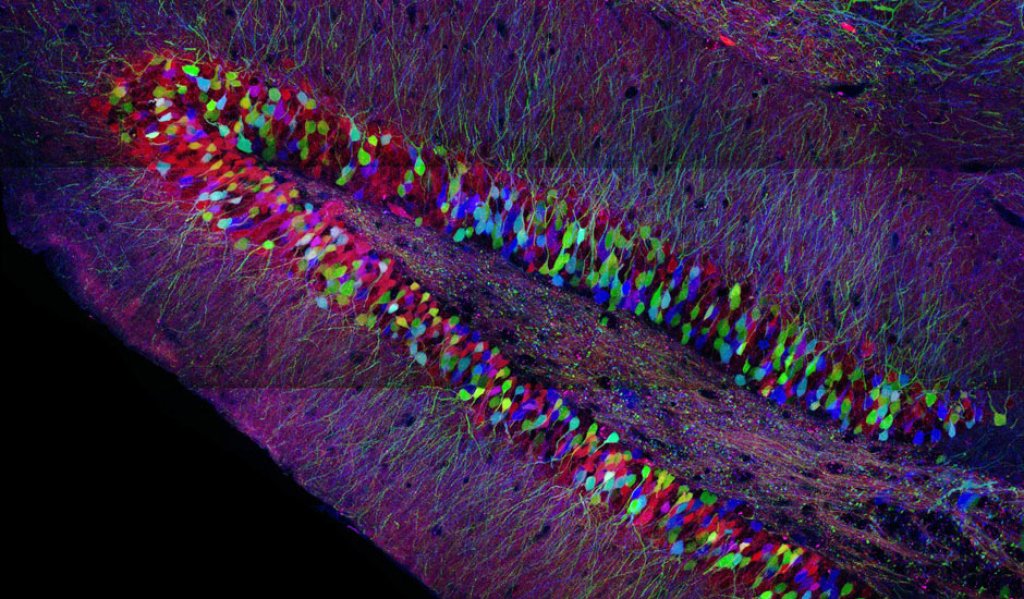 Fluorescence microscopy of a hippocampus from a \"brainbow\" mouse. This mouse carries an artificial gene that causes nerve cells to light up in different colors.