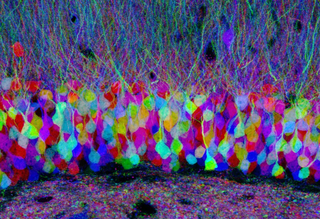 Different colored nerve cells from the mouse hippocampus of a \"Brainbow\" mouse. This mouse carries an artificial gene that causes nerve cells to light up in different colors.